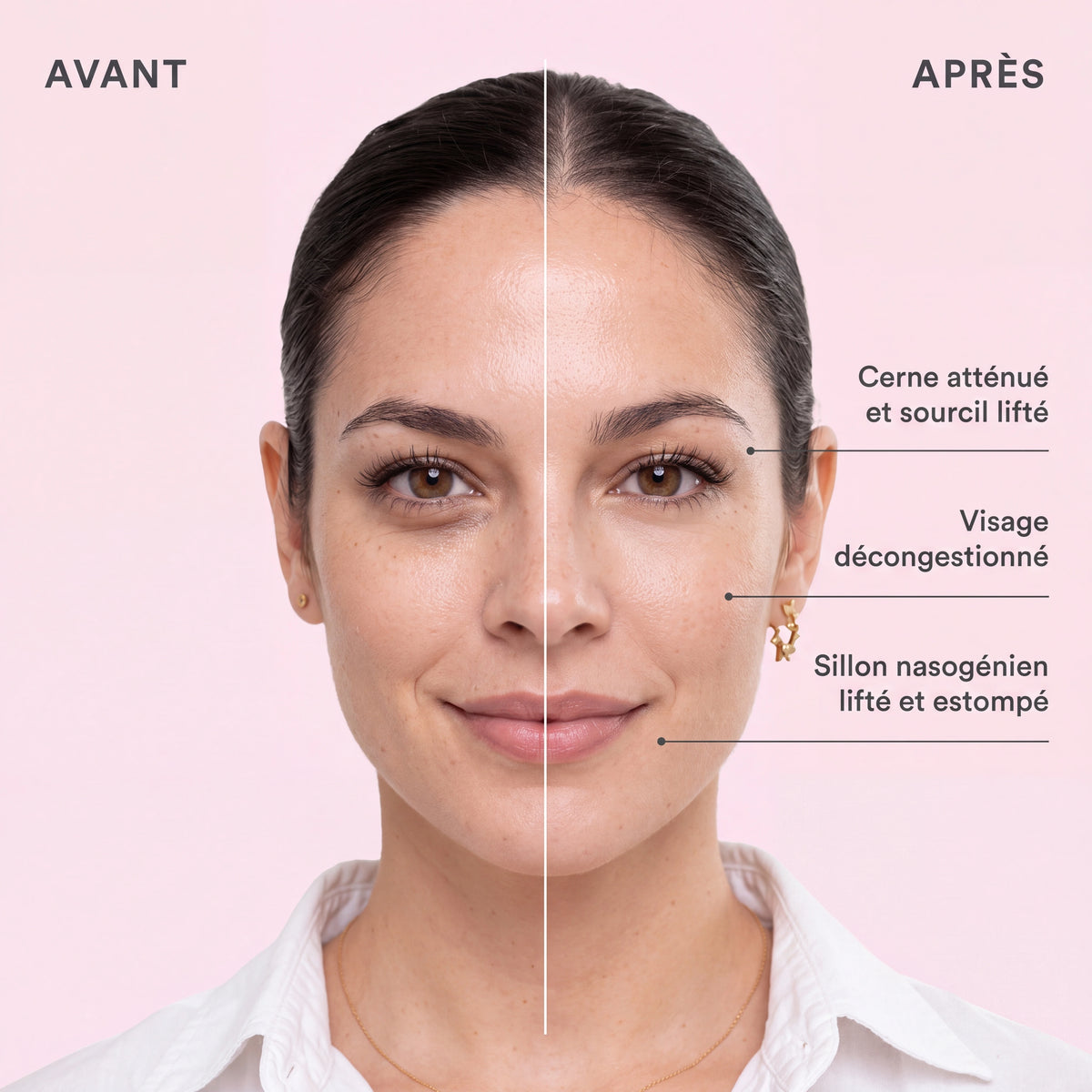 ICE GLOBE VISAGE | CRYO ICE GLOW